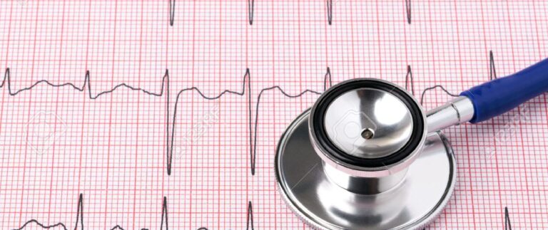 13203176-photo-of-an-electrocardiogram-ecg-or-ekg-printout-with-stethoscope 13203176-photo-of-an-electrocardiogram-ecg-or-ekg-printout-with-stethoscope